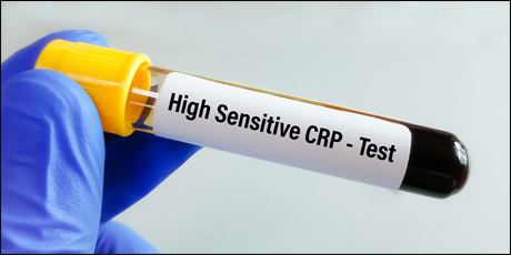 Hs CRP Test Hs CRP Test