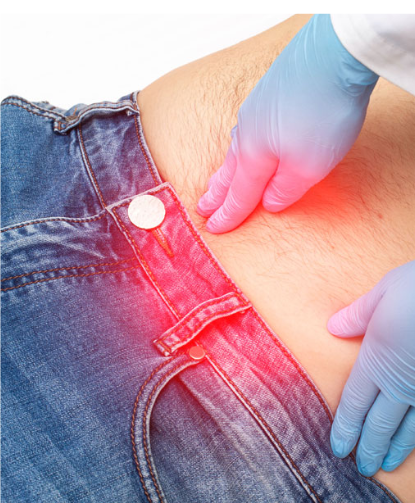 Encapsulating Peritoneal 