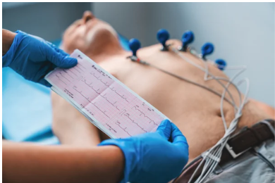 ELECTROCARDIOGRAM (ECG / EKG)