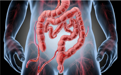 Upadoz / Upadacitinib in IBD